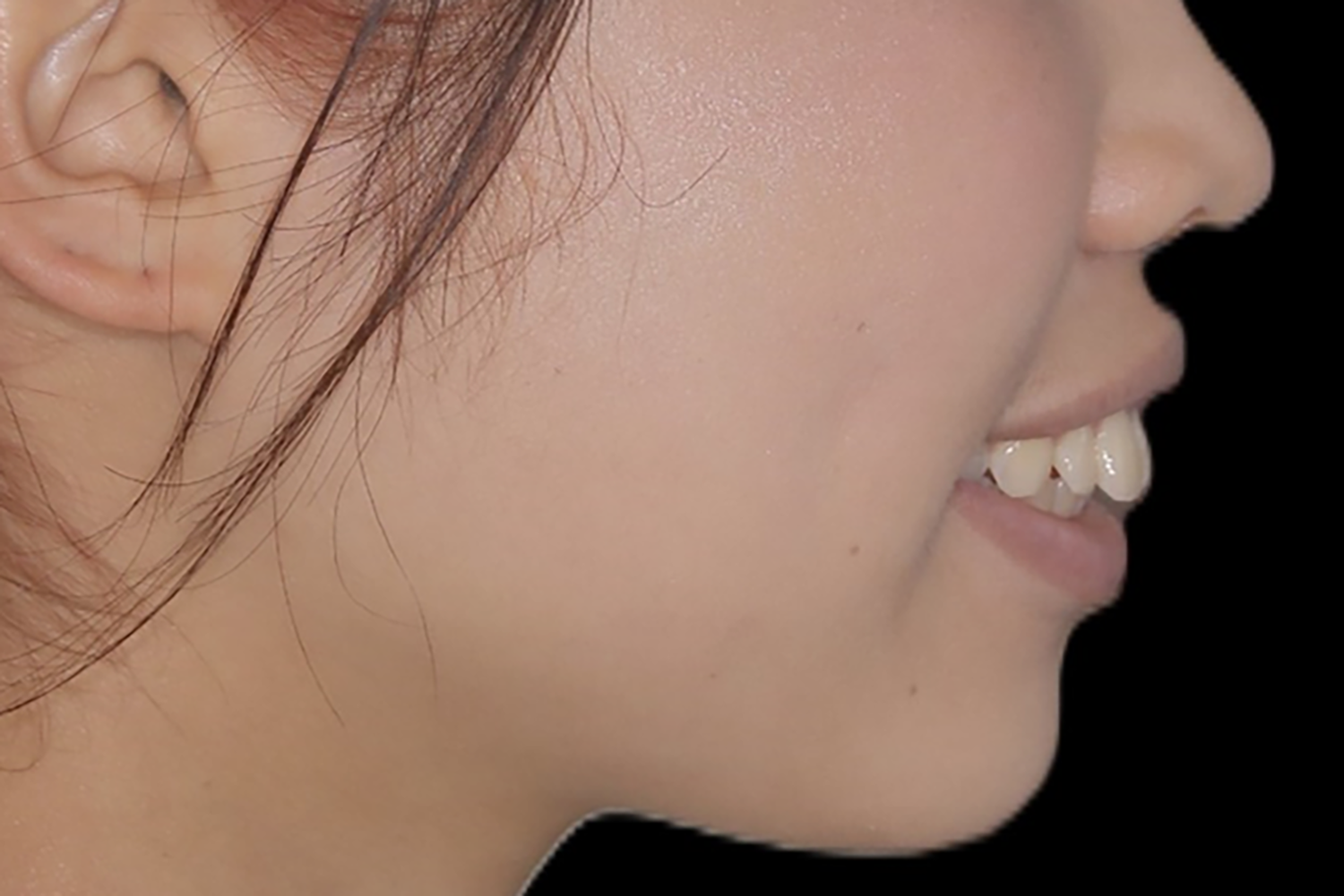 Before