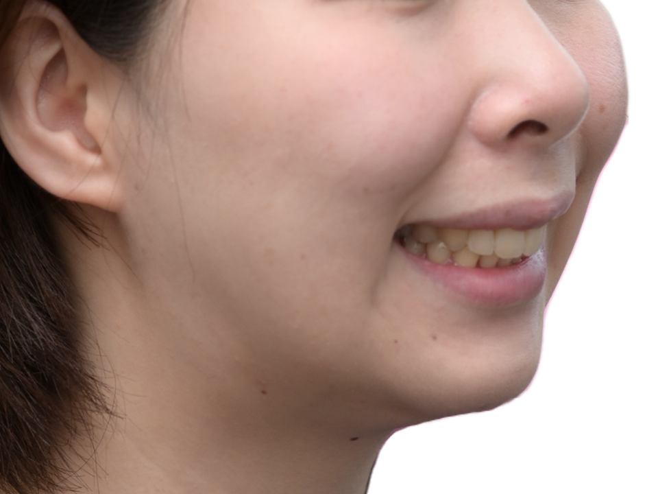 After